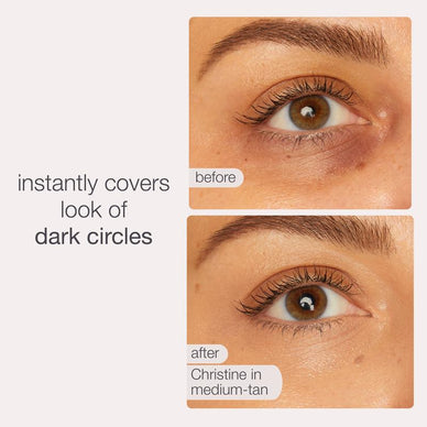 "Illuminate Your Eyes, Transform Your Confidence"